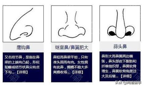 肉鼻子面相|鼻相分析10款｜鼻樑有節及橫紋、豬膽鼻、鼻頭下垂代表甚麼？姻 